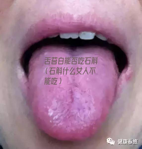 舌苔白能否吃石斛